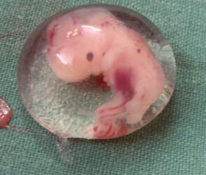 Are Human Embryos Fully Human?