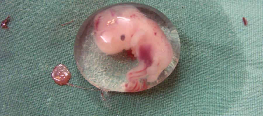 Are Human Embryos Fully Human?